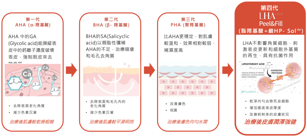 介紹不同類型酸類產品的圖示，分別說明AHA、BHA、PHA和LHA的特點與效果，強調LHA在皮膚再生和改善膚質方面的優勢，適合用於皮膚護理的教育與宣傳。